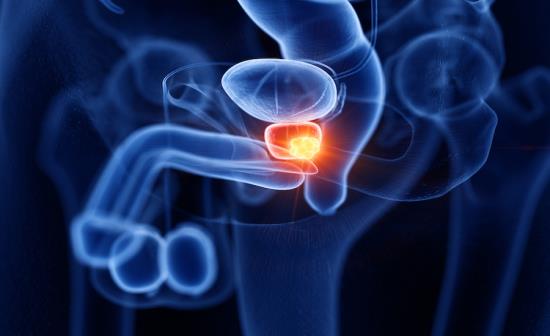 Tumore della prostata: prioritari informazione e prevenzione primaria anche tra i medici di famiglia