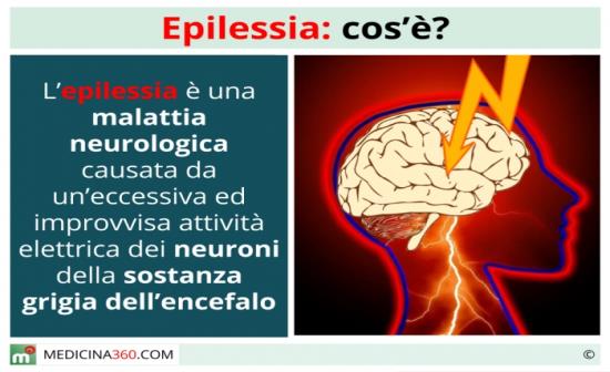 Epilessia Definizioni e classificazioni dell'epilessia, di crisi epilettica, stato di male epilettico 